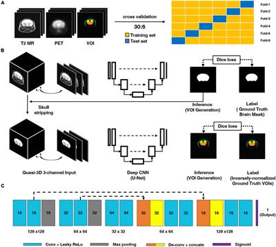 Unified Deep Learning-Based Mouse Brain MR Segmentation: Template-Based Individual Brain Positron Emission Tomography Volumes-of-Interest Generation Without Spatial Normalization in Mouse Alzheimer Model